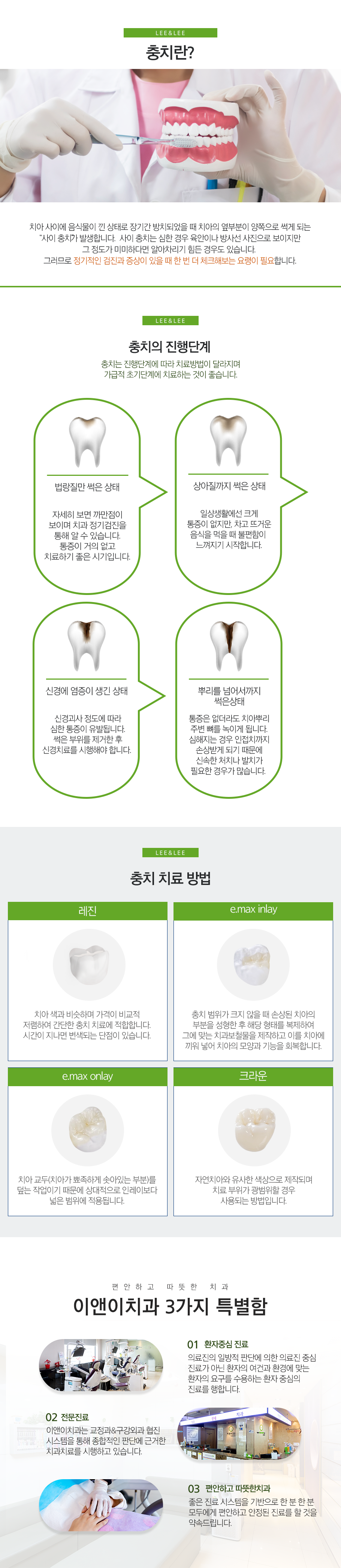 충치치료