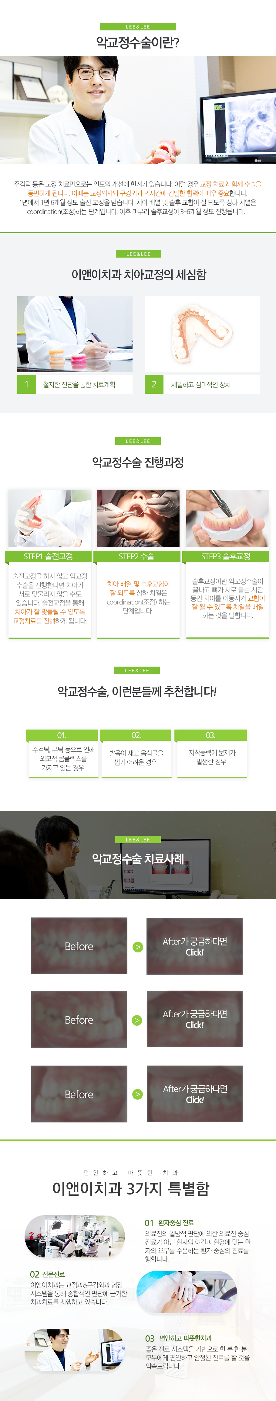 악교정수술